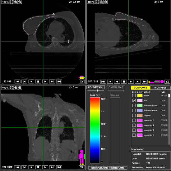 Quand le grid peut aider à combattre le cancer…
